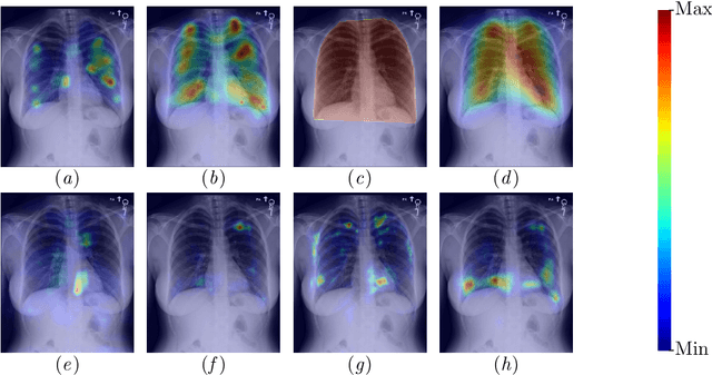 Figure 1 for Comparing radiologists' gaze and saliency maps generated by interpretability methods for chest x-rays