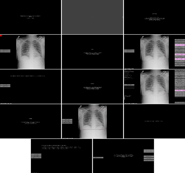 Figure 3 for REFLACX, a dataset of reports and eye-tracking data for localization of abnormalities in chest x-rays