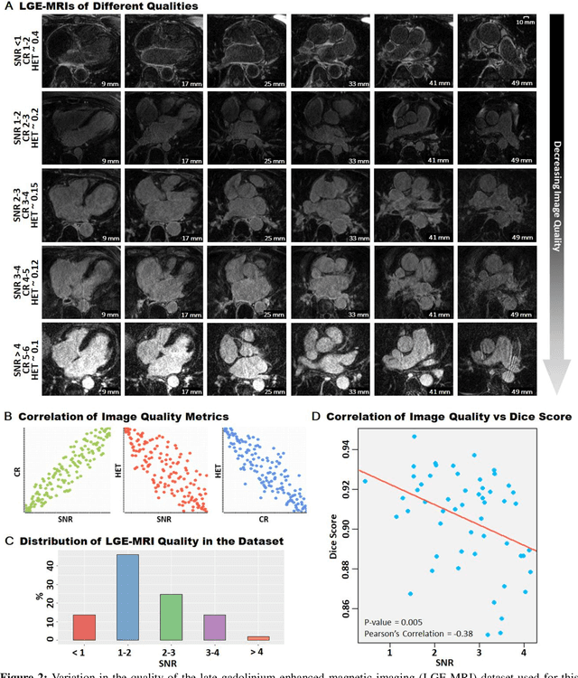 Figure 2 for A Global Benchmark of Algorithms for Segmenting Late Gadolinium-Enhanced Cardiac Magnetic Resonance Imaging
