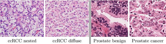 Figure 3 for Stain based contrastive co-training for histopathological image analysis