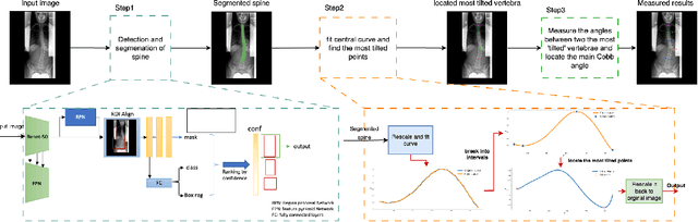 Figure 1 for Deep learning automates Cobb angle measurement compared with multi-expert observers