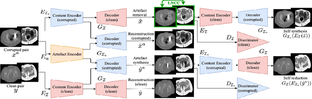 Figure 1 for Combining multimodal information for Metal Artefact Reduction: An unsupervised deep learning framework