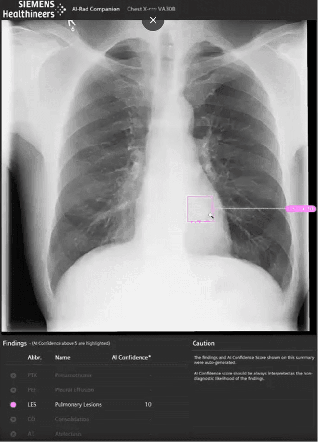 Figure 4 for Routine Usage of AI-based Chest X-ray Reading Support in a Multi-site Medical Supply Center