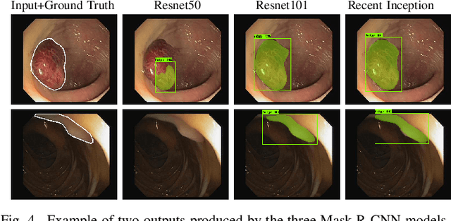 Figure 4 for Polyp Detection and Segmentation using Mask R-CNN: Does a Deeper Feature Extractor CNN Always Perform Better?