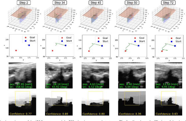 Figure 2 for Image-Guided Navigation of a Robotic Ultrasound Probe for Autonomous Spinal Sonography Using a Shadow-aware Dual-Agent Framework