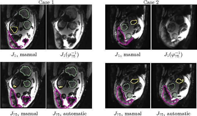 Figure 2 for Temporal Registration in In-Utero Volumetric MRI Time Series