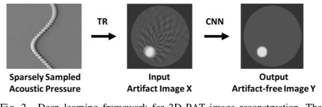 Figure 2 for Fully Dense UNet for 2D Sparse Photoacoustic Tomography Artifact Removal