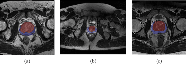Figure 1 for USE-Net: incorporating Squeeze-and-Excitation blocks into U-Net for prostate zonal segmentation of multi-institutional MRI datasets