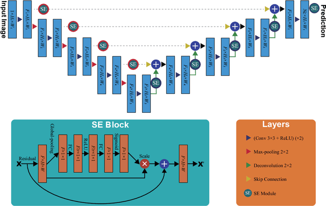 Figure 3 for USE-Net: incorporating Squeeze-and-Excitation blocks into U-Net for prostate zonal segmentation of multi-institutional MRI datasets