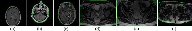 Figure 4 for MRQy: An Open-Source Tool for Quality Control of MR Imaging Data