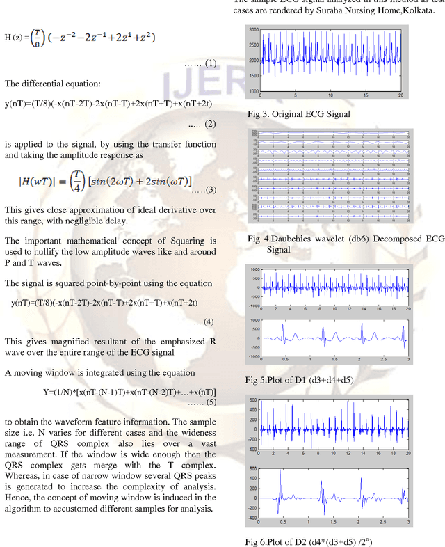 Figure 2 for Wavelet Based QRS Complex Detection of ECG Signal