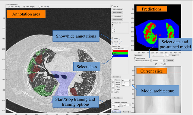 Figure 1 for Interactive user interface based on Convolutional Auto-encoders for annotating CT-scans