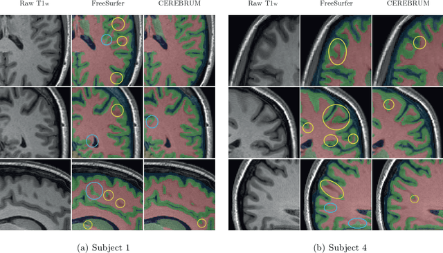 Figure 3 for CEREBRUM: a fast and fully-volumetric Convolutional Encoder-decodeR for weakly-supervised sEgmentation of BRain strUctures from out-of-the-scanner MRI