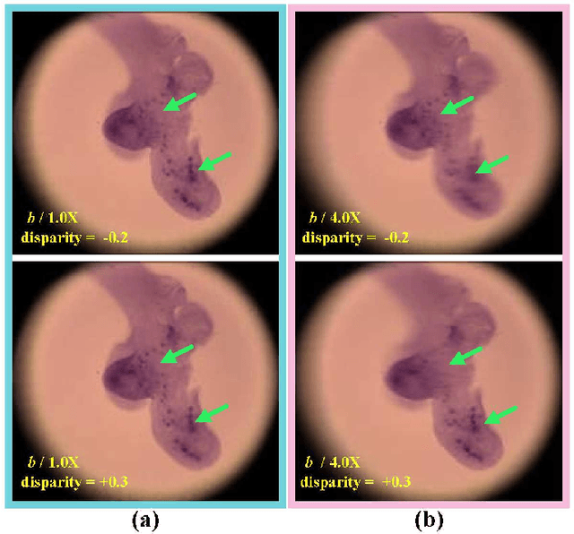 Figure 1 for A learning-based view extrapolation method for axial super-resolution