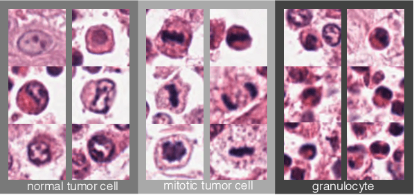 Figure 1 for A Guided Spatial Transformer Network for Histology Cell Differentiation