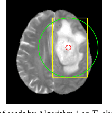 Figure 4 for A CADe System for Gliomas in Brain MRI using Convolutional Neural Networks