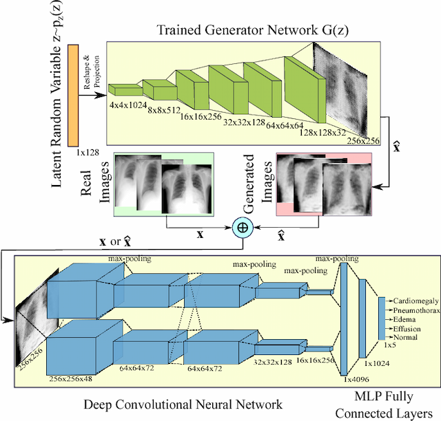 Figure 3 for Generalization of Deep Neural Networks for Chest Pathology Classification in X-Rays Using Generative Adversarial Networks