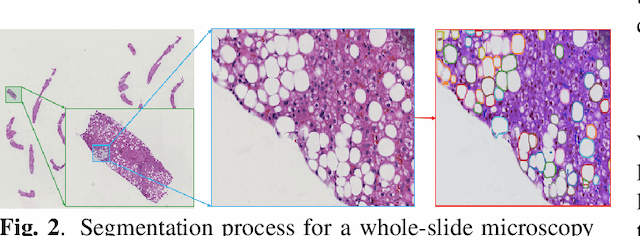 Figure 3 for Liver Steatosis Segmentation with Deep Learning Methods