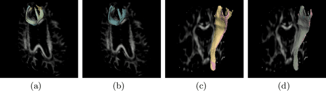 Figure 4 for Reproducible White Matter Tract Segmentation Using 3D U-Net on a Large-scale DTI Dataset