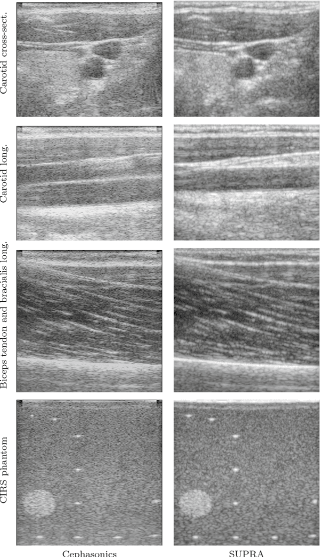 Figure 4 for SUPRA: Open Source Software Defined Ultrasound Processing for Real-Time Applications
