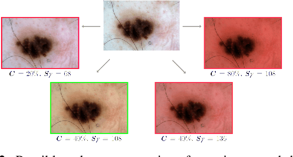 Figure 3 for Leveraging Adaptive Color Augmentation in Convolutional Neural Networks for Deep Skin Lesion Segmentation