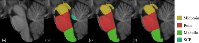 Figure 3 for Automated brainstem parcellation using multi-atlas segmentation and deep neural network