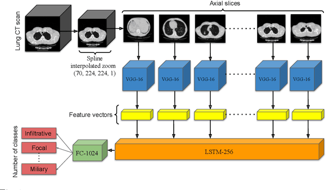 Figure 1 for ViPTT-Net: Video pretraining of spatio-temporal model for tuberculosis type classification from chest CT scans