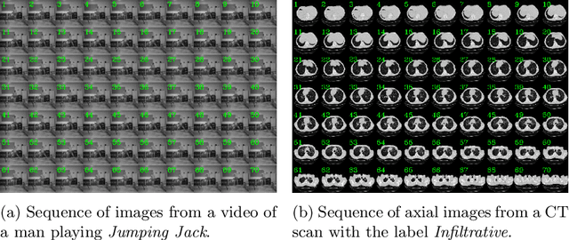 Figure 3 for ViPTT-Net: Video pretraining of spatio-temporal model for tuberculosis type classification from chest CT scans