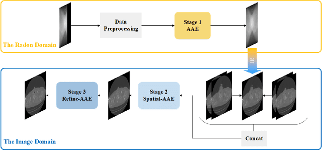Figure 3 for Real-Time Limited-View CT Inpainting and Reconstruction with Dual Domain Based on Spatial Information