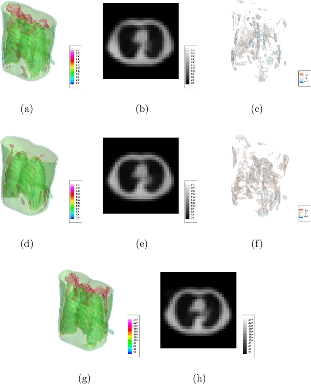 Figure 4 for X2CT-FLOW: Reconstruction of multiple volumetric chest computed tomography images with different likelihoods from a uni- or biplanar chest X-ray image using a flow-based generative model