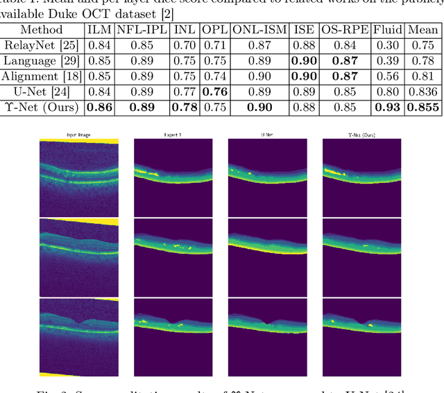 Figure 2 for $Υ$-Net: A Spatiospectral Network for Retinal OCT Segmentation