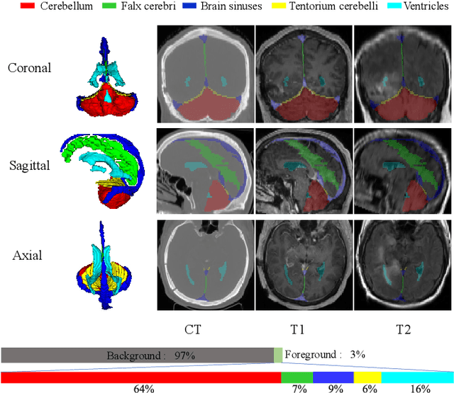 Figure 1 for HMRNet: High and Multi-Resolution Network with Bidirectional Feature Calibration for Brain Structure Segmentation in Radiotherapy