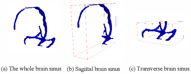 Figure 3 for HMRNet: High and Multi-Resolution Network with Bidirectional Feature Calibration for Brain Structure Segmentation in Radiotherapy