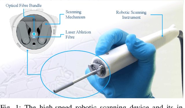Figure 1 for Intraoperative robotic-assisted large-area high-speed microscopic imaging and intervention