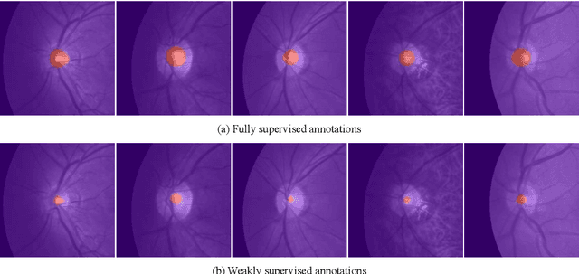 Figure 4 for ACCL: Adversarial constrained-CNN loss for weakly supervised medical image segmentation