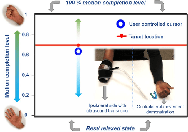 Figure 2 for Proprioceptive Sonomyographic Control: A novel method of intuitive proportional control of multiple degrees of freedom for upper-extremity amputees