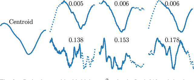Figure 1 for Shift-invariant waveform learning on epileptic ECoG