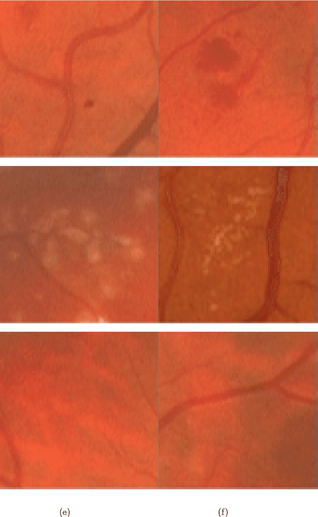 Figure 3 for A Two-phase Decision Support Framework for the Automatic Screening of Digital Fundus Images