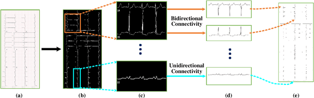 Figure 1 for CRT-Net: A Generalized and Scalable Framework for the Computer-Aided Diagnosis of Electrocardiogram Signals
