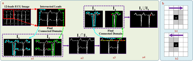 Figure 3 for CRT-Net: A Generalized and Scalable Framework for the Computer-Aided Diagnosis of Electrocardiogram Signals