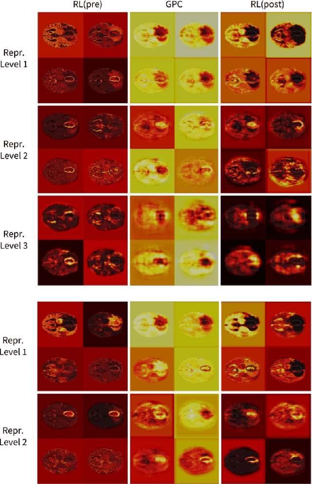 Figure 3 for Global Planar Convolutions for improved context aggregation in Brain Tumor Segmentation