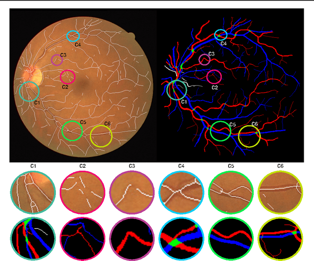 Figure 1 for Analysis of Vessel Connectivities in Retinal Images by Cortically Inspired Spectral Clustering