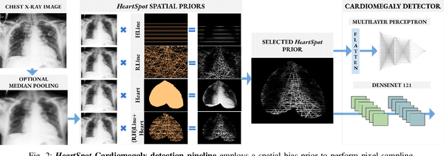 Figure 2 for HeartSpot: Privatized and Explainable Data Compression for Cardiomegaly Detection