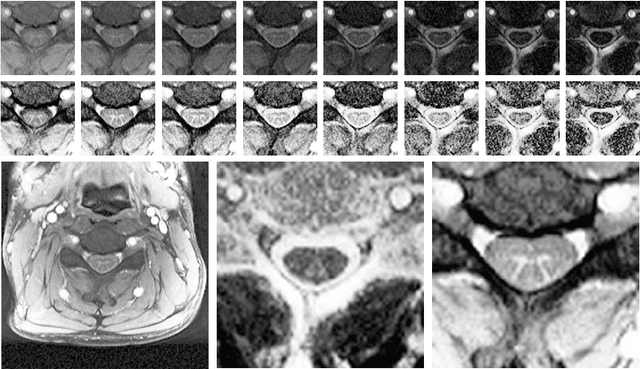 Figure 1 for Spinal Cord Gray Matter-White Matter Segmentation on Magnetic Resonance AMIRA Images with MD-GRU