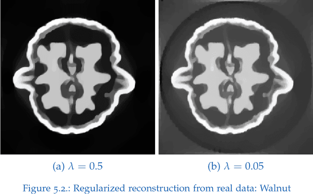 Figure 4 for TV-regularized CT Reconstruction and Metal Artifact Reduction Using Inequality Constraints with Preconditioning