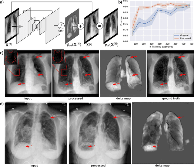Figure 1 for Separation of target anatomical structure and occlusions in chest radiographs