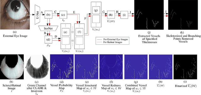 Figure 4 for A Thickness Sensitive Vessel Extraction Framework for Retinal and Conjunctival Vascular Tortuosity Analysis
