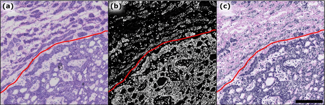 Figure 2 for Single Acquisition Label-free Histology-like Imaging with Dual Contrast Photoacoustic Remote Sensing Microscopy