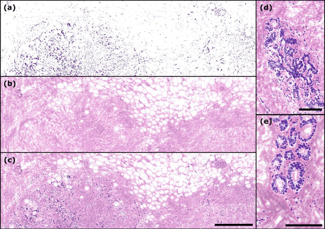 Figure 3 for Single Acquisition Label-free Histology-like Imaging with Dual Contrast Photoacoustic Remote Sensing Microscopy