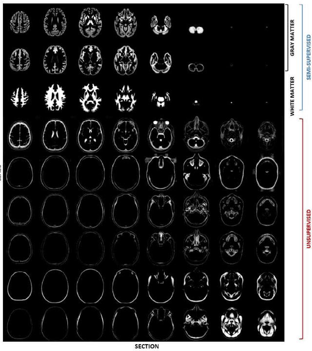 Figure 4 for Generative diffeomorphic atlas construction from brain and spinal cord MRI data